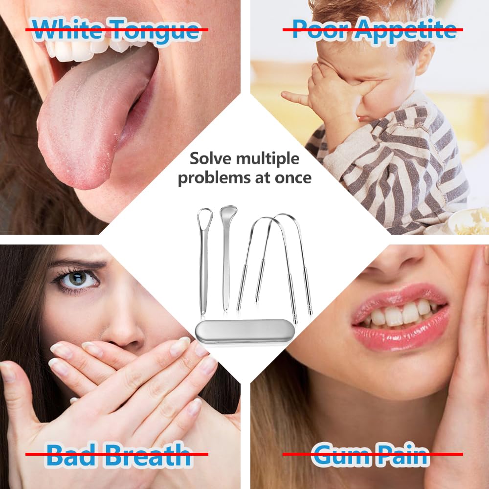 Tongue Scraper Set (3pcs)